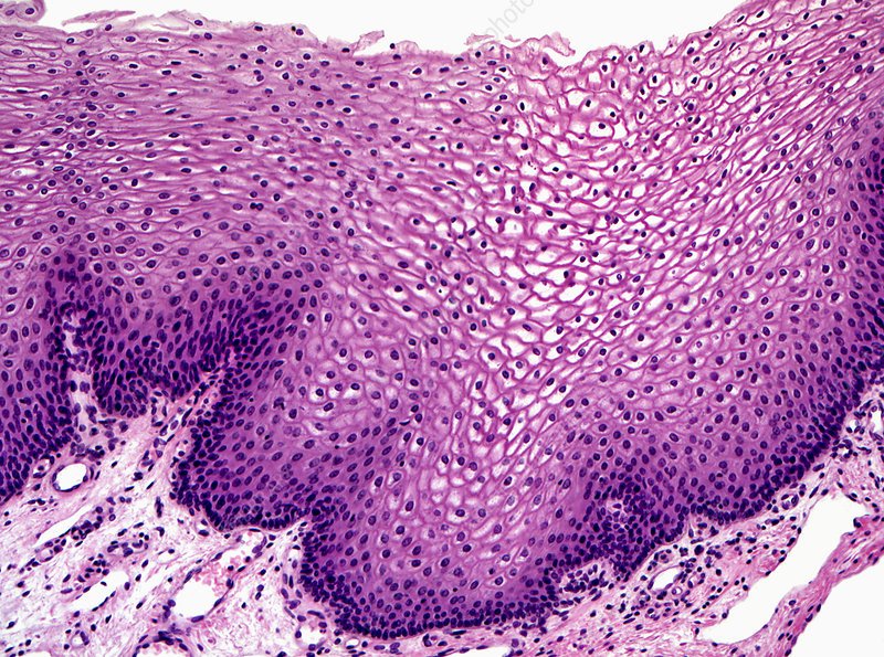 sgc-normal esophagus